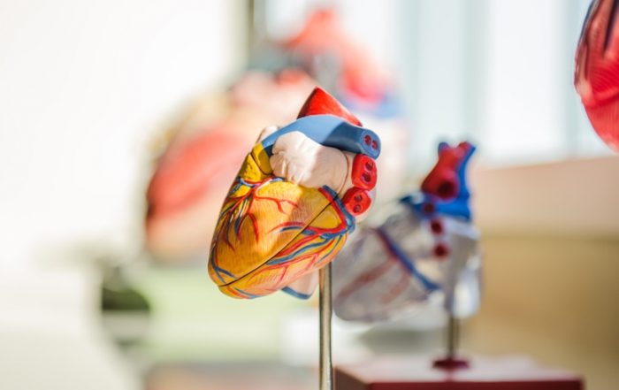 artificial intelligence AI machine learning high performance computing HPC heart defects coarctation of the aorta CoA Cardiology AIMed virtual event 3D printing research medicine healthcaare physician clinician patient simulation study CT MRT scans imaging